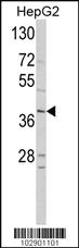 Anti-NEUROD1 Rabbit Polyclonal Antibody