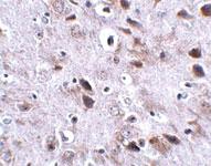 Anti-TMEM18 Rabbit Polyclonal Antibody