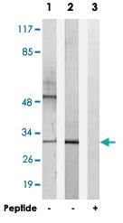 Anti-HOXD10 Rabbit Polyclonal Antibody