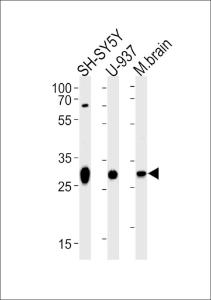 Anti-ANP32E Rabbit Polyclonal Antibody