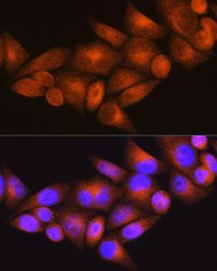 Immunofluorescence analysis of HeLa cells using Anti-WFS1 Antibody (A11473) at a dilution of 1:100 (40X lens). DAPI was used to stain the cell nuclei (blue)