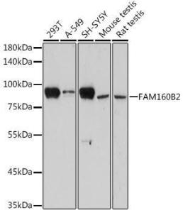 Western blot analysis of extracts of various cell lines, using Anti-FHIP2B Antibody (A305971) at 1:1,000 dilution. The secondary antibody was Goat Anti-Rabbit IgG H&L Antibody (HRP) at 1:10,000 dilution.