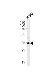 Anti-BBS5 Rabbit Polyclonal Antibody