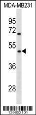 Anti-OR1Q1 Rabbit Polyclonal Antibody