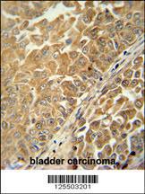 Anti-CR025 Rabbit Polyclonal Antibody (Biotin)