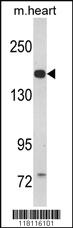 Anti-CORIN Rabbit Polyclonal Antibody