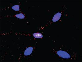 Anti-SMAD1 + GLI3 Antibody Pair