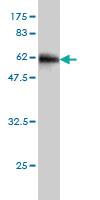 Anti-SDSL Mouse Monoclonal Antibody [clone: 2F8-6C9]