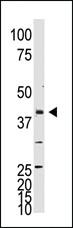 Anti-NEUROD1 Rabbit Polyclonal Antibody