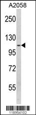 Anti-SPINK5 Rabbit Polyclonal Antibody