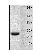 Annexin v recombina 20014 100 µg