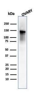 Western blot analysis of human ovary tissue lysate using Anti-Caldesmon Antibody [SPM168]