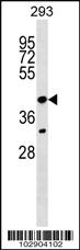 Anti-NEUROD1 Rabbit Polyclonal Antibody