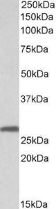 Anti-SFN antibody