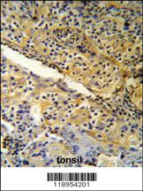 Anti-SPINK5 Rabbit Polyclonal Antibody