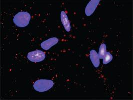 Anti-HNF4A + FOXO1 Antibody Pair