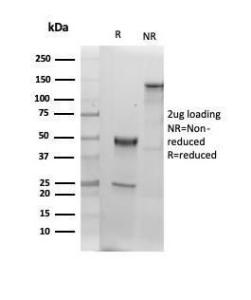 SDS-PAGE analysis of Anti-Albumin Antibody [ALB/6409R] under non-reduced and reduced conditions; showing intact IgG and intact heavy and light chains, respectively. SDS-PAGE analysis confirms the integrity and purity of the antibody