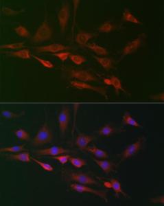 Immunofluorescence analysis of C6 cells using Anti-FHIP2B Antibody (A305971) at a dilution of 1:100 (40x lens). DAPI was used to stain the cell nuclei (blue).