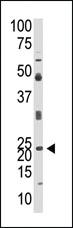 Anti-NEUROG1 Rabbit Polyclonal Antibody