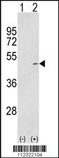 Anti-NPR2 Rabbit Polyclonal Antibody