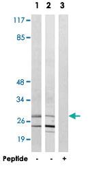 Anti-NKX2-6 Rabbit Polyclonal Antibody