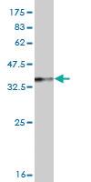 Anti-RTKN Mouse Monoclonal Antibody [clone: 2E5]