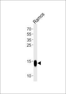 Anti-TCL1A Rabbit Polyclonal Antibody