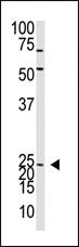 Anti-NEUROG2 Rabbit Polyclonal Antibody