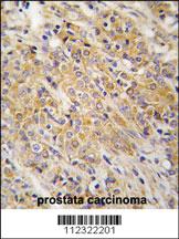 Anti-NPR2 Rabbit Polyclonal Antibody