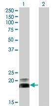 Anti-HAND2 Mouse Monoclonal Antibody [clone: 3D5]