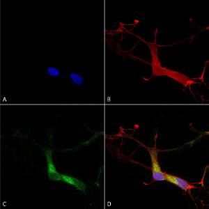 Immunocytochemistry/Immunofluorescence analysis of human neuroblastoma cells (SH-SY5Y), fixed in 4% PFA for 15 min, using Anti-HCN1 Antibody [S70] (A304768), at 1:100 for overnight at 4°C with slow rockin