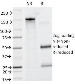 SDS-PAGE analysis of Anti-Caldesmon Antibody [CALD1/820] under non-reduced and reduced conditions; showing intact IgG and intact heavy and light chains, respectively. SDS-PAGE analysis confirms the integrity and purity of the antibody