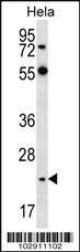 Anti-NEUROG2 Rabbit Polyclonal Antibody