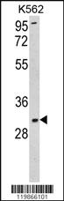 Anti-UBN2 Rabbit Polyclonal Antibody