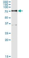 Anti-PPM1J Polyclonal Antibody Pair