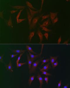 Immunofluorescence analysis of NIH/3T3 cells using Anti-FHIP2B Antibody (A305971) at a dilution of 1:100 (40x lens). DAPI was used to stain the cell nuclei (blue).