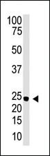 Anti-NEUROG3 Rabbit Polyclonal Antibody