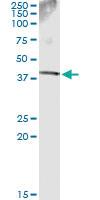 Anti-SDSL Antibody Pair