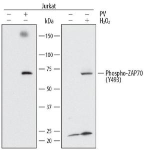 Anti-ZAP70 Mouse Monoclonal Antibody