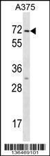 Anti-KRT75 Rabbit Polyclonal Antibody (Biotin)