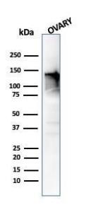 Western blot analysis of human ovary tissue lysate using Anti-Caldesmon Antibody [CALD1/820]