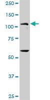 Anti-PKN1 Rabbit Polyclonal Antibody