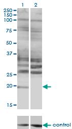 Anti-HAND2 Mouse Monoclonal Antibody [clone: 3D5]