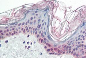 Anti-PARP2 Antibody (A84168) (5µg/ml) staining of paraffin embedded Human Skin. Steamed antigen retrieval with citrate buffer pH 6, AP-staining.