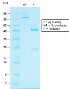 SDS-PAGE analysis of Anti-Glypican 3 Antibody [GPC3/1534R] under non-reduced and reduced conditions; showing intact IgG and intact heavy and light chains, respectively. SDS-PAGE analysis confirms the integrity and purity of the antibody