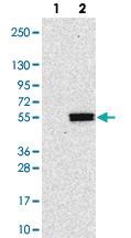 Anti-POGLUT1 Rabbit Polyclonal Antibody