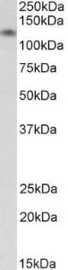 Anti-CDH13 Antibody (A82654) (003 µg/ml) staining of Human Heart lysate (35 µg protein in RIPA buffer) Primary incubation was 1 hour Detected by chemiluminescence