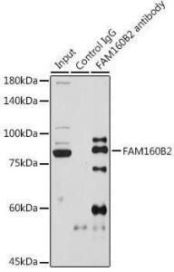 Immunoprecipitation analysis of 600µg extracts of rat testis cells using 3µg of Anti-FHIP2B Antibody (A305971). This Western blot was performed on the immunoprecipitate using Anti-FHIP2B Antibody (A305971) at a dilution of 1:1000.