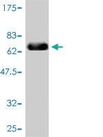 Anti-TYR Mouse Monoclonal Antibody [clone: 2A2-F4]