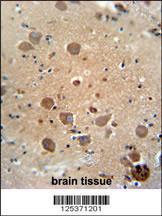 Anti-CF062 Rabbit Polyclonal Antibody (FITC (Fluorescein Isothiocyanate))